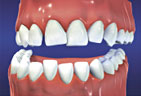 Orthodontic1